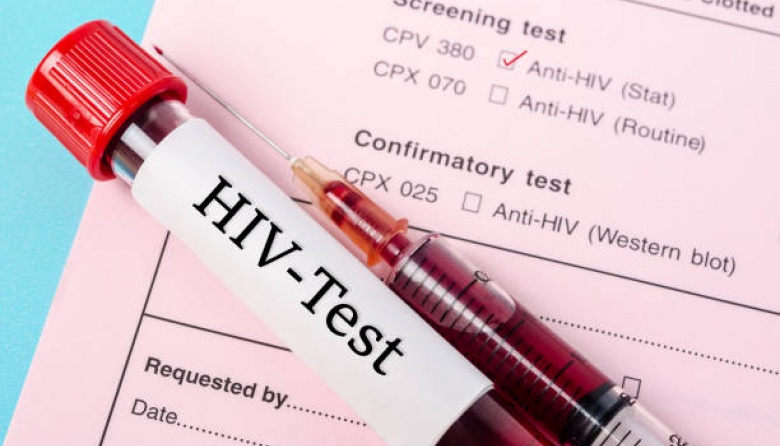 SIDA/VHI: Un diagnóstico temprano puede evitar el desarrollo de la enfermedad
